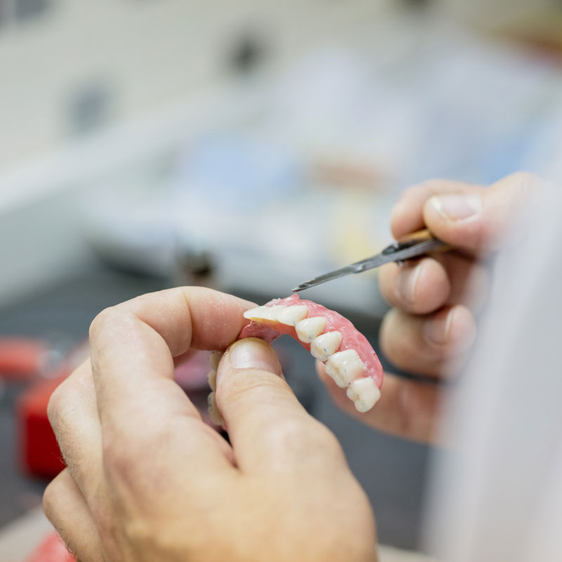 Denture-Repairs Repairing dentures